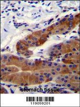 Anti-DFNB31 (Center) Antibody