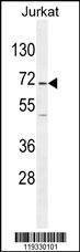 Anti-GAD2 (Center) Antibody