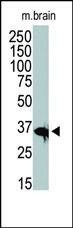 Anti-HDAC11 (C-term) Antibody