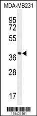 Anti-FOXA2 (Center) Antibody