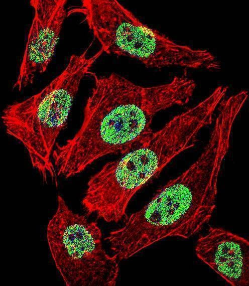 Anti-FOXA2 (Center) Antibody
