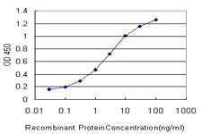 Anti-ATRX Antibody
