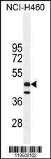 Anti-FGL2 (C-term) Antibody