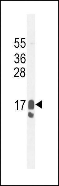 Anti-GCDFP-15 (C-term) Antibody