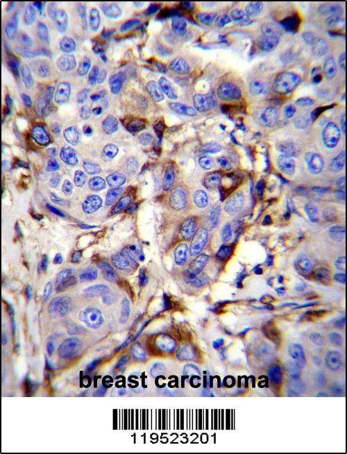 Anti-GCDFP-15 (C-term) Antibody
