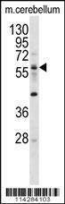 Anti-ELP3 (N-term) Antibody