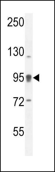 Anti-ACAP1 (N-term) Antibody