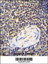 Anti-ACAP1 (N-term) Antibody