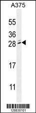 Anti-MBD3L2 (C-term) Antibody