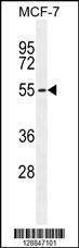 Anti-PMPCA (C-term) Antibody