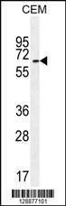 Anti-UNCX (C-term) Antibody