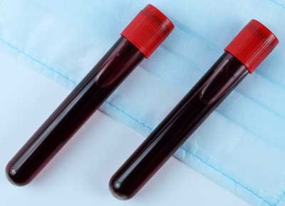 COVID-19 Whole Blood