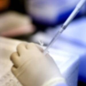 Custom Polyclonal Antibody Production