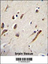Anti-FBXW11 (Center) Antibody
