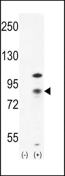 Anti-CTNB1 (C-term) Antibody