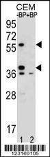 Anti-MNDA (N-term) Antibody