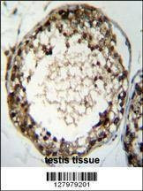 Anti-TSSK4 (C-term) Antibody