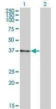 Anti-B3GAT3 Antibody