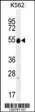Anti-KRT25 (C-term) Antibody
