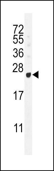 Anti-GAGE12B (N-term) Antibody