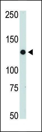 Anti-JAK2 (C-term) Antibody