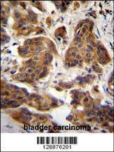 Anti-C4orf21 (N-term) Antibody