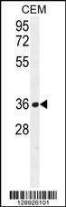 Anti-NUDT22 (C-term) Antibody