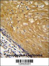 Anti-NUDT22 (C-term) Antibody