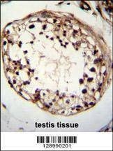 Anti-TSPYL6 (Center) Antibody