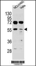 Anti-TSPYL6 (Center) Antibody