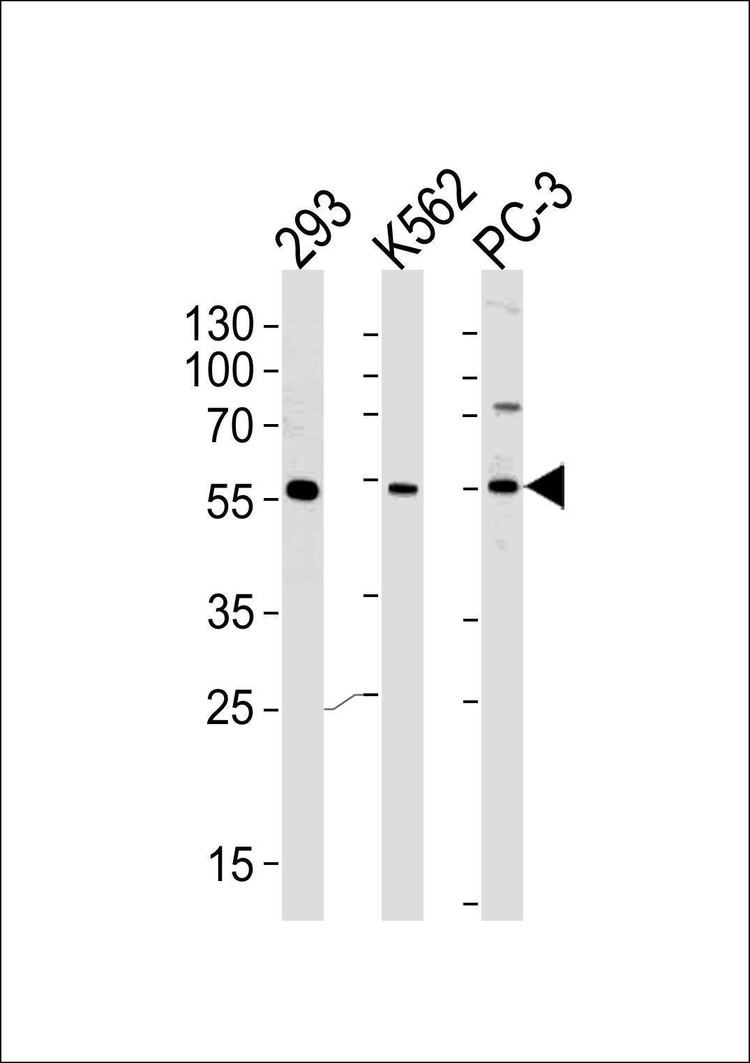 Anti-PIP5KL1 (N-term) Antibody
