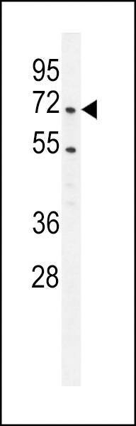 Anti-PRMT4 (Center) Antibody