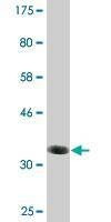 Anti-BAALC Antibody