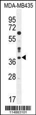 Anti-CASP3 (C-term) Antibody