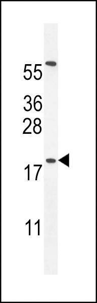 Anti-DPPA5 (N-term) Antibody