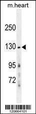 Anti-Mouse GRIN2A (Center) Antibody