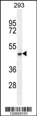 Anti-COCH (C-term) Antibody