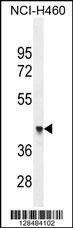 Anti-FX4L1 (N-term) Antibody