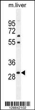 Anti-Mouse PHOX2B (Center) Antibody