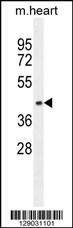 Anti-AP1M1 (Center) Antibody