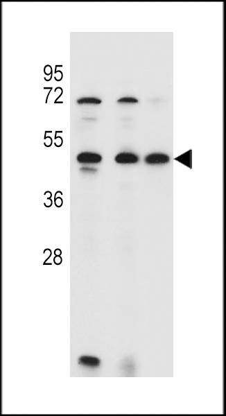Anti-ANKRD40 (C-term) Antibody