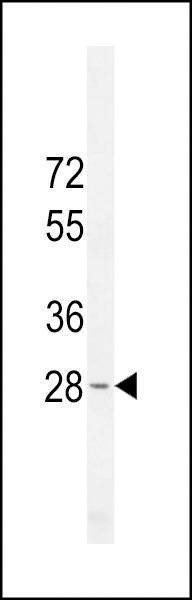 Anti-METTL10 (N-term) Antibody