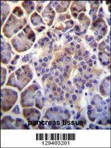 Anti-C6orf138 (Center) Antibody