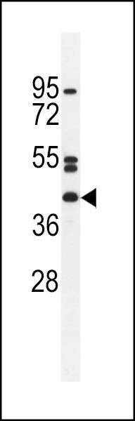 Anti-NT5DC4 (Center) Antibody