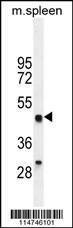 Anti-LZP Antibody