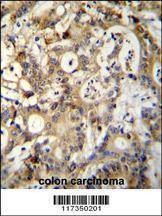 Anti-SP1 (C-term P692) Antibody
