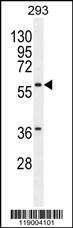 Anti-CPA2 (Center) Antibody