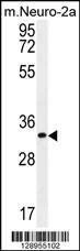 Anti-ZC3H8 (N-term) Antibody