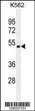 Anti-NUDT19 (Center) Antibody