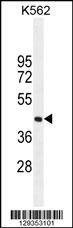 Anti-SIGLEC15 (C-term) Antibody